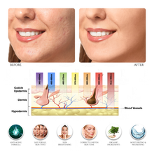 8 ÉLÉMENT PRO | Masque LED multi-usages pour soins de la peau | Nouvelle génération sans fil