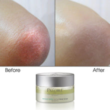 Routine complète de soulagement du stress corporel avec mucine d'escargot, sel de mer et rétinol | Peau sèche et rugueuse, psoriasis et callosités | (Édition limitée)