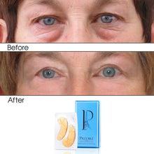 Ensemble de masques sous les yeux 12 en 1 pour le renouvellement cellulaire au collagène et l'oxygène + la vitamine E
