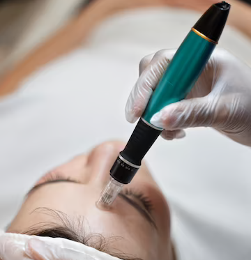 Microneedling Mesotherapy