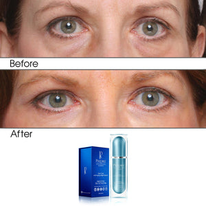 Intensive Rapid Renewal Eye Care Anti Aging Night Serum (Treats Puffiness and Dark Circles)